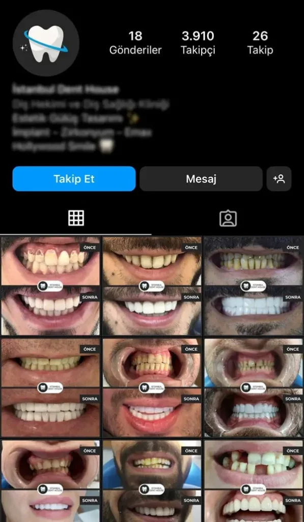 diş kliniği sosyal medya yönetimi örneği